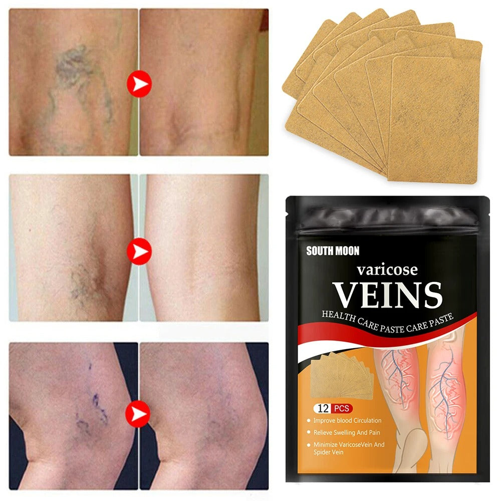 4 CAJAS DE PARCHES PARA VARICES