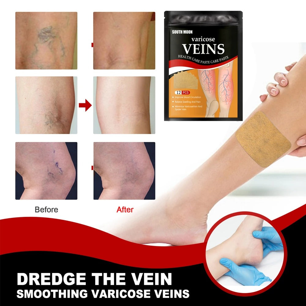 4 CAJAS DE PARCHES PARA VARICES